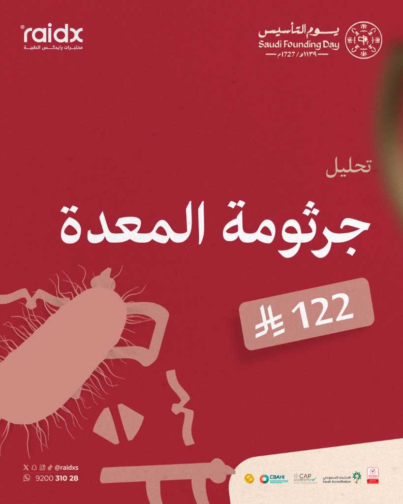 تحليل جرثومة المعدة UBT (يوم التأسيس)